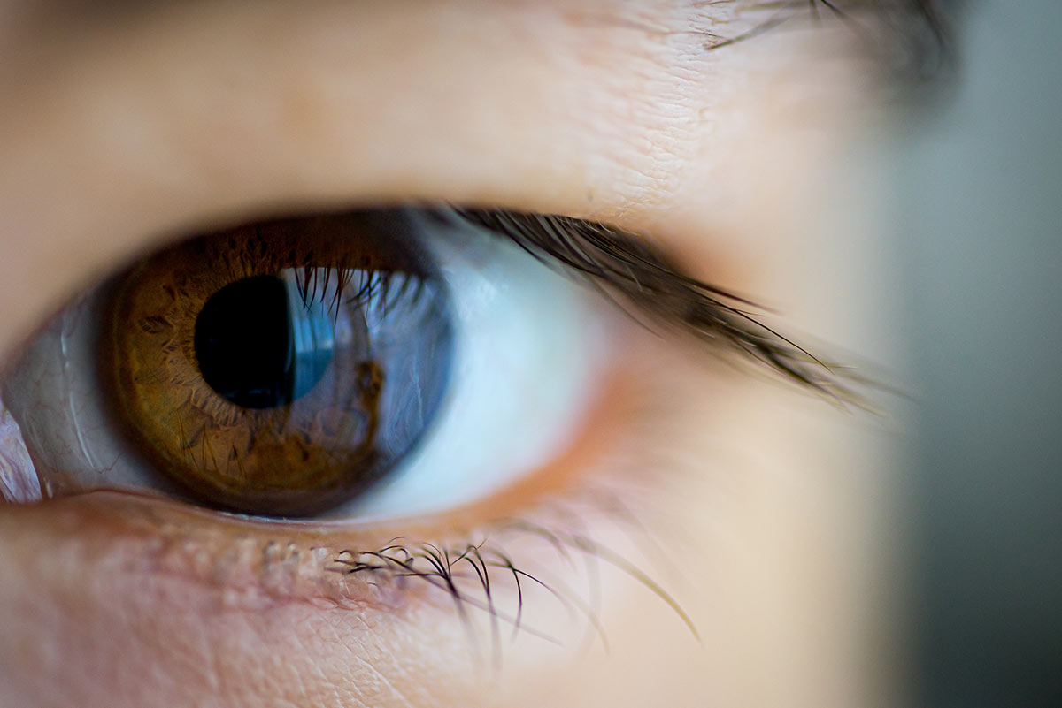 Retina Mata Robek: Apakah Bisa Sembuh?