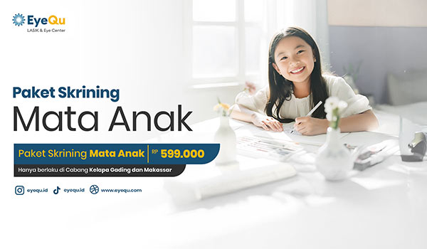Paket Skrining Mata Anak Rp 599.000